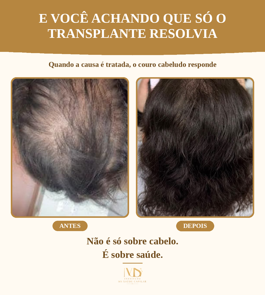 Antes_Depois_1