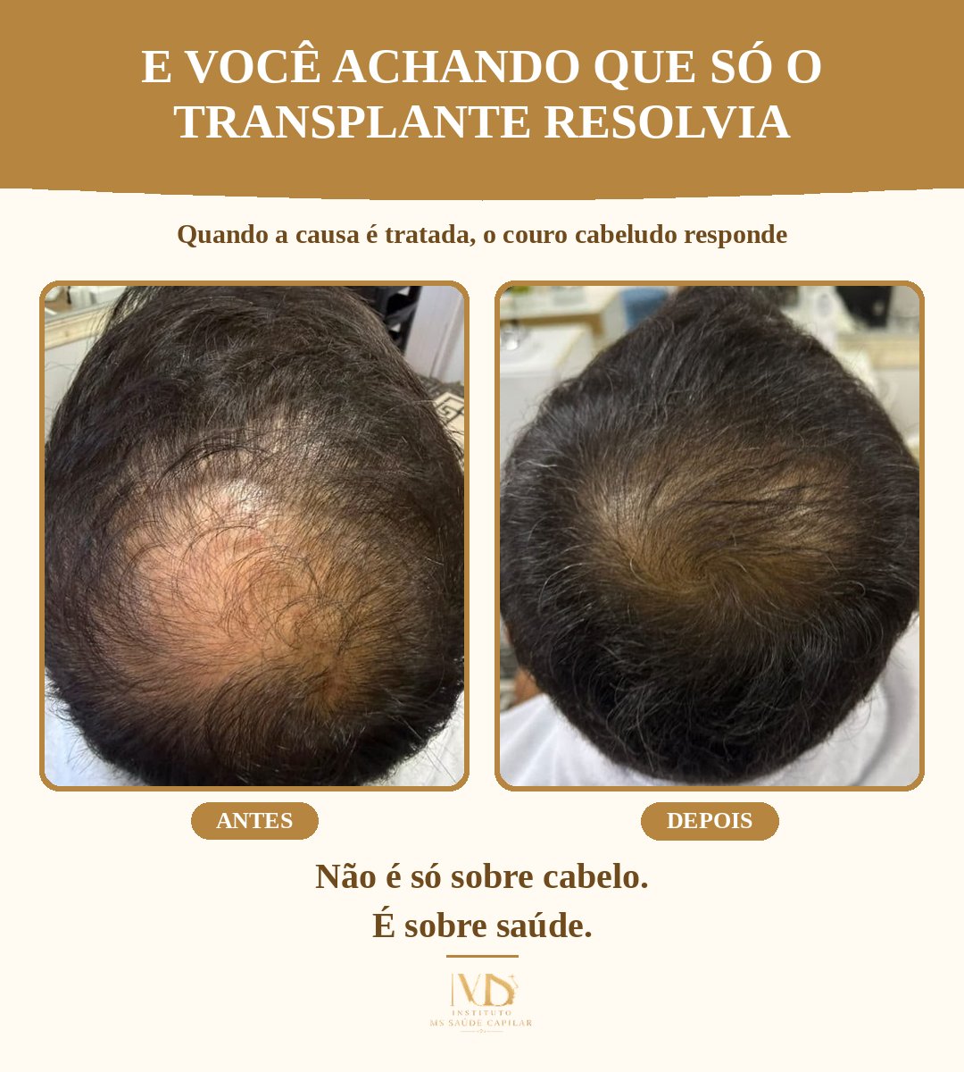 Antes_Depois_2