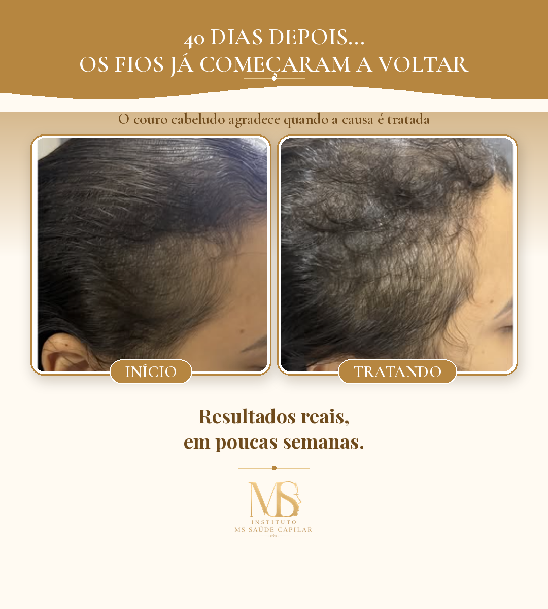 Antes_Depois_2_40dias