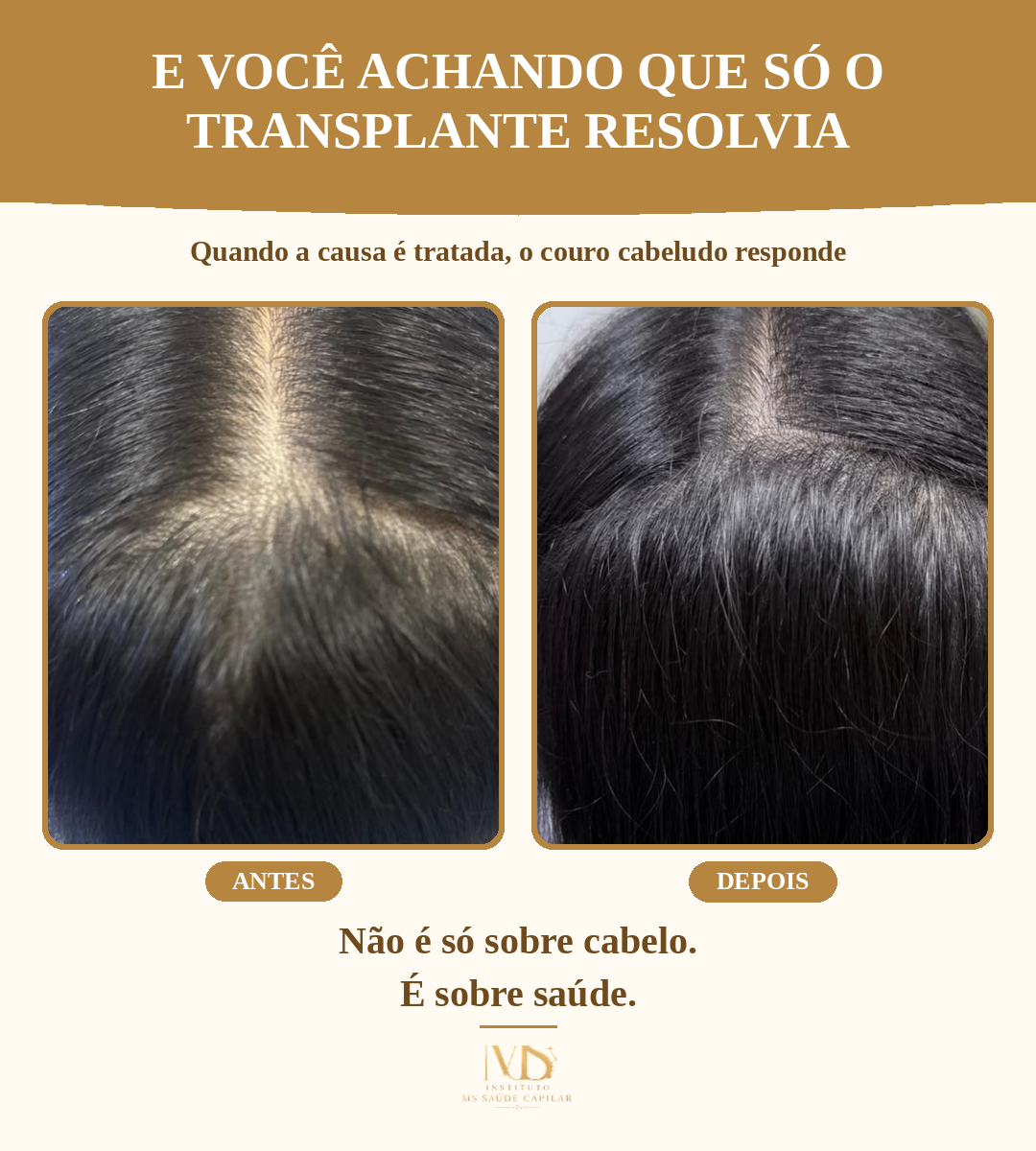 Antes_Depois_3