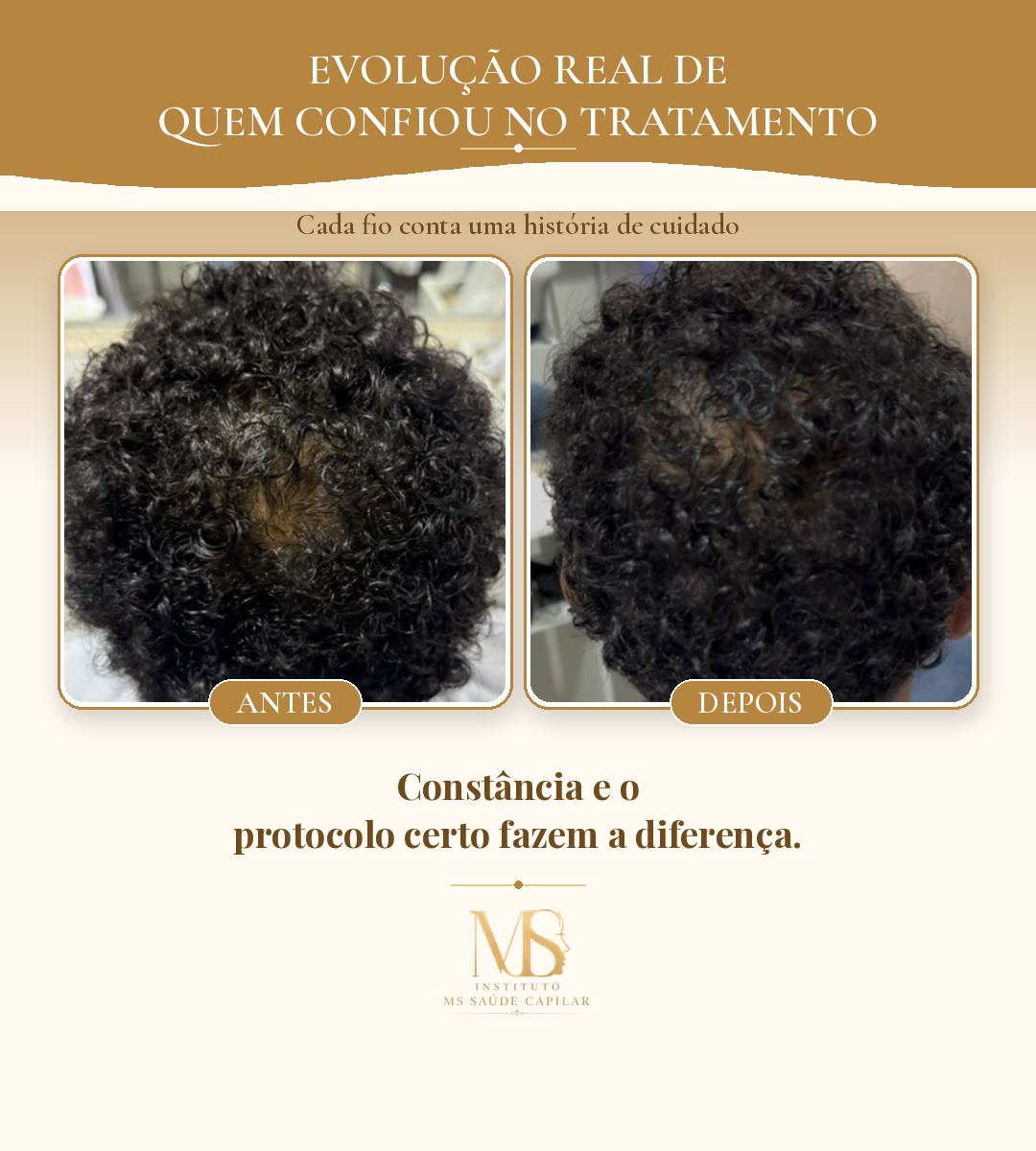 Antes_Depois_3_Evolucao
