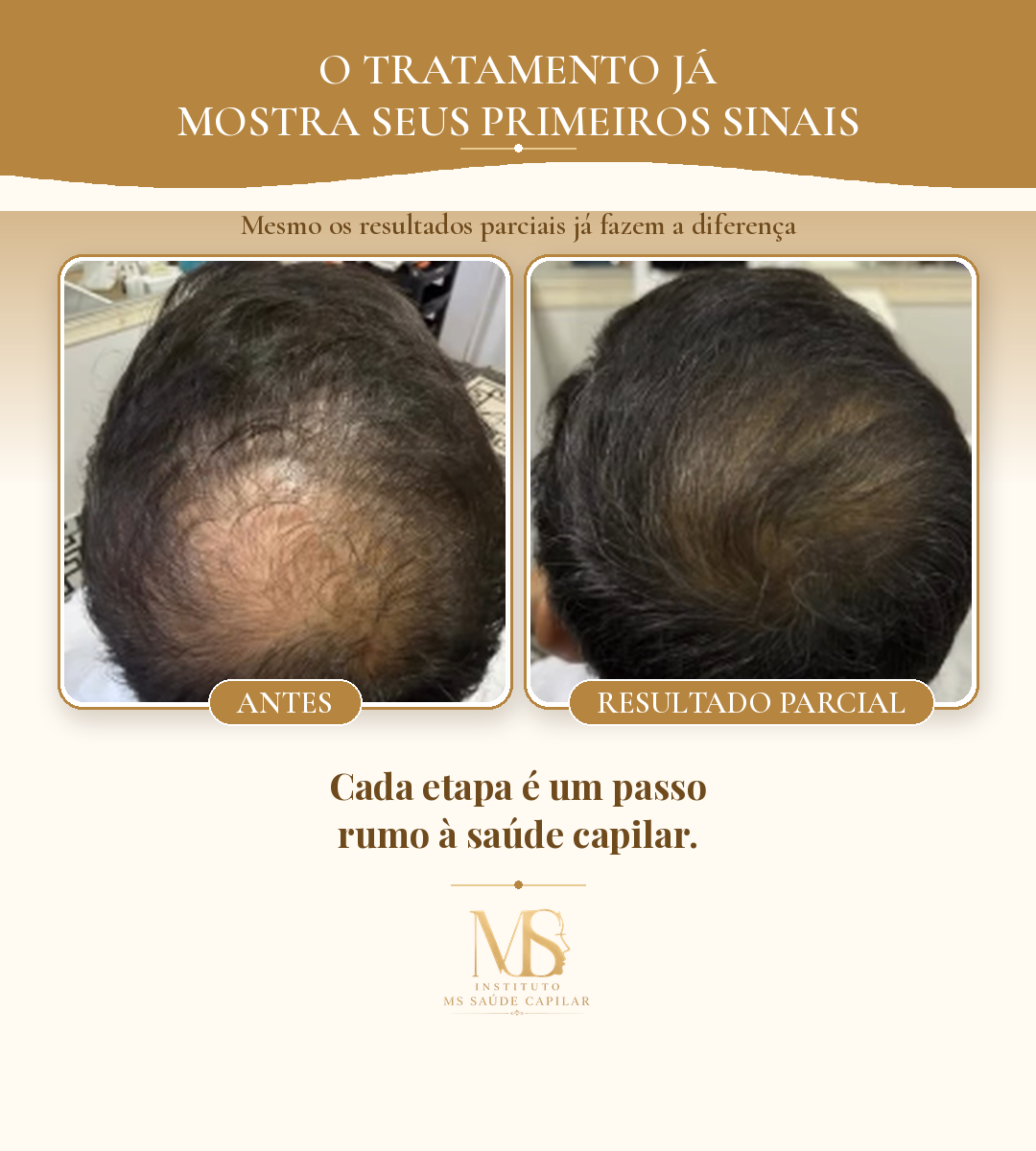Antes_Depois_4_ResultadoParcial